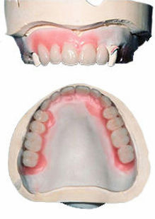 dentures denture