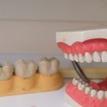 How Dentures Can Help to Improve Your Smile