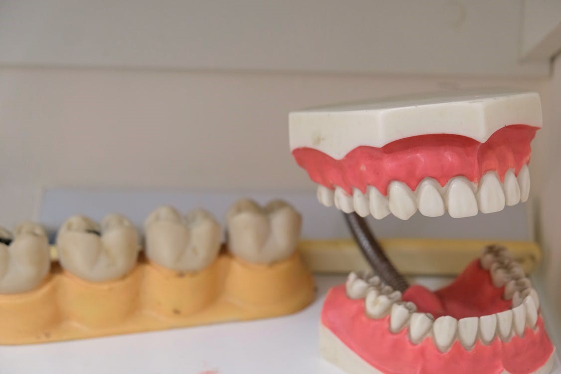 How Dentures Can Help to Improve Your Smile