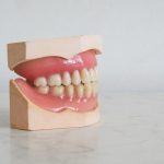 Know About Benefits of Partial Dentures