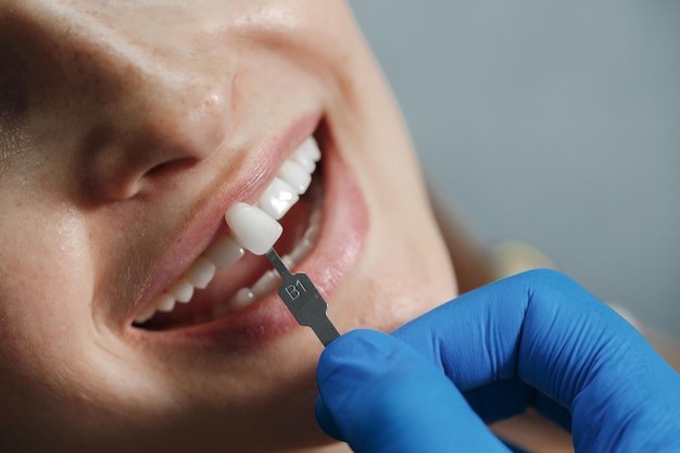 Cost-Effective Dental Treatments