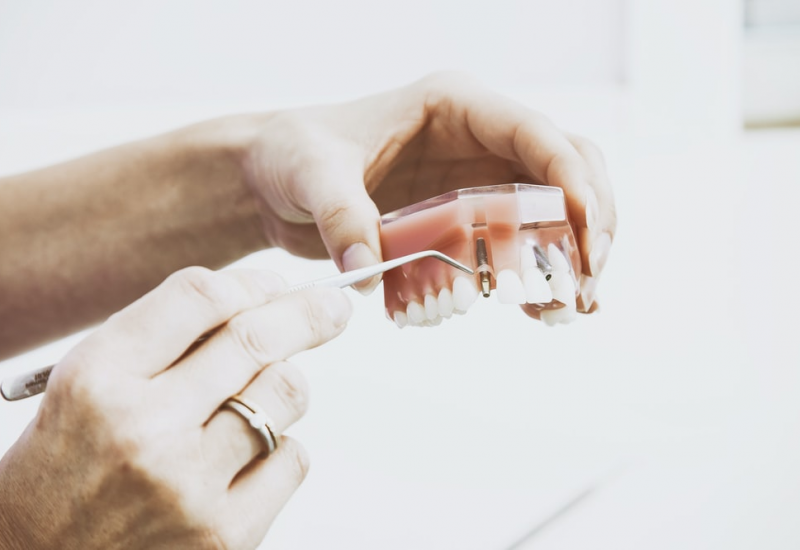 denture repairs near me